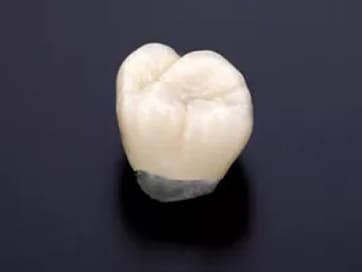 カラーレスメタルボンド